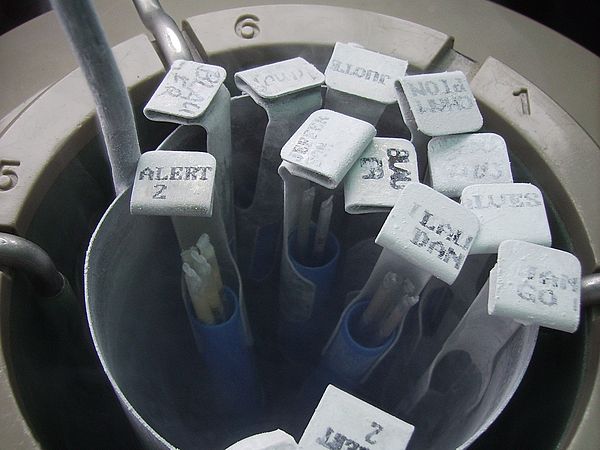 
            Autre technique d’Insémination Artificielle: La décongélation