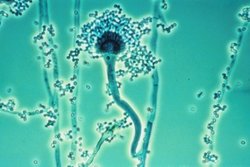 
          Aspergillus spp (Moisissures de stockage)