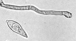 
          Pyriculariose du riz (Magnaporthe grisea)