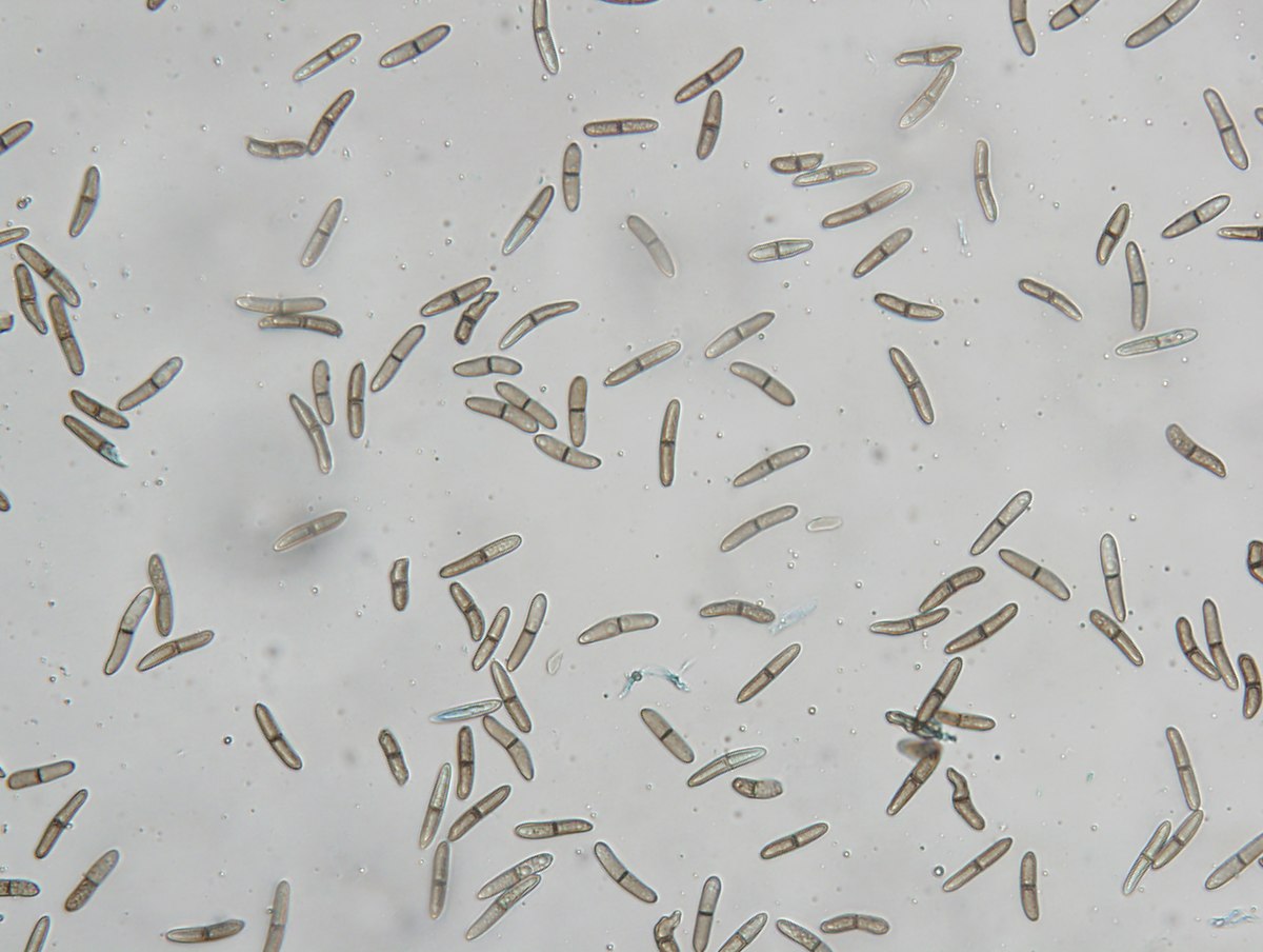 
          Stenocarpella maydis (pourriture de l'épi et de la tige du maïs)