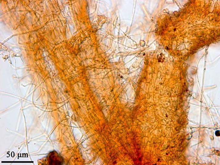 
          Phymatotrichopsis omnivora (Pourriture racinaire à Phymatotrichum)