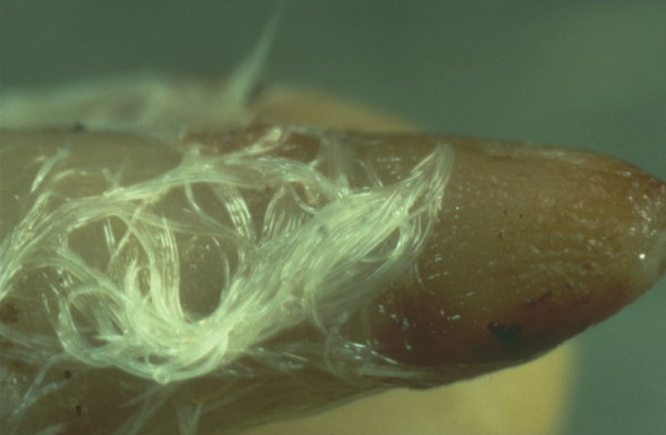 
          Anguillule des céréales et des bulbes (Ditylenchus dipsaci)