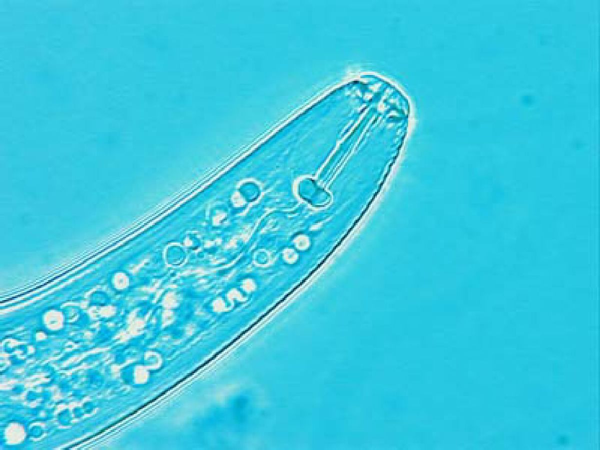 
          Nématode endoparasite migrateur des racines (Pratylenchus penetrans)